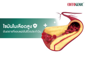 Read more about the article ป้องกันไขมันในเลือดสูง เริ่มต้นง่ายๆได้ที่ตัวคุณ